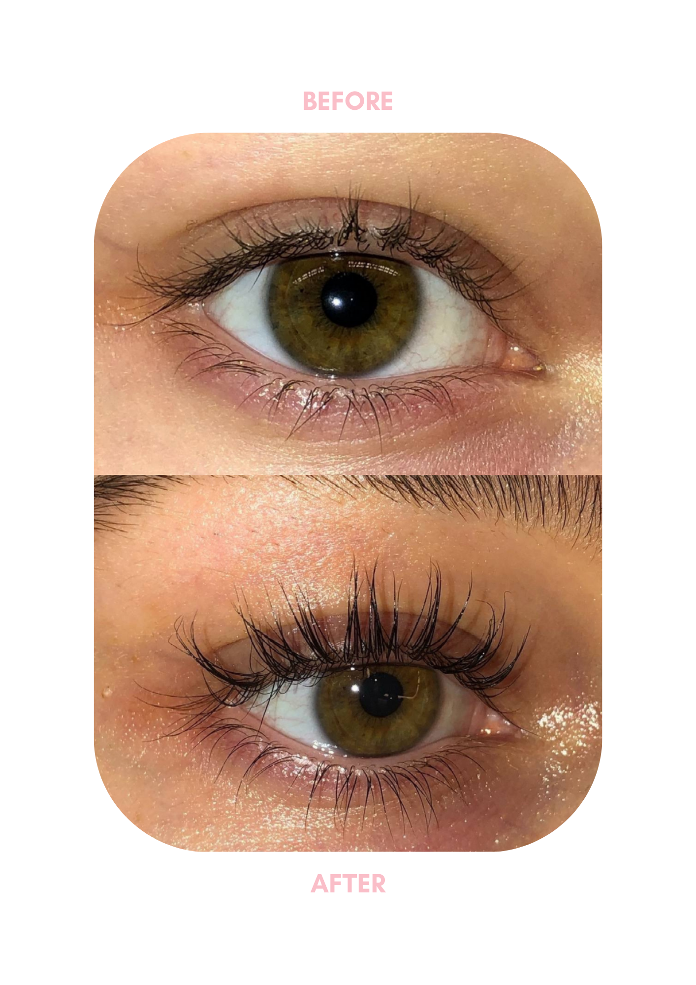 Eyelash Serum